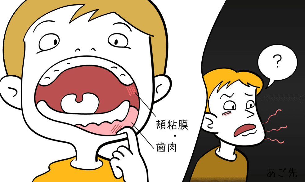 口腔內壁腫起來​