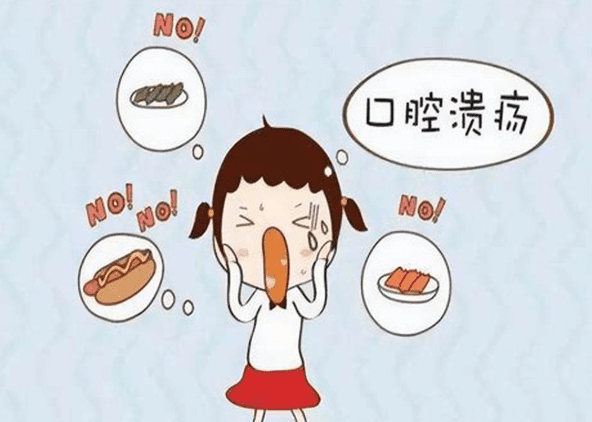 口腔潰瘍​