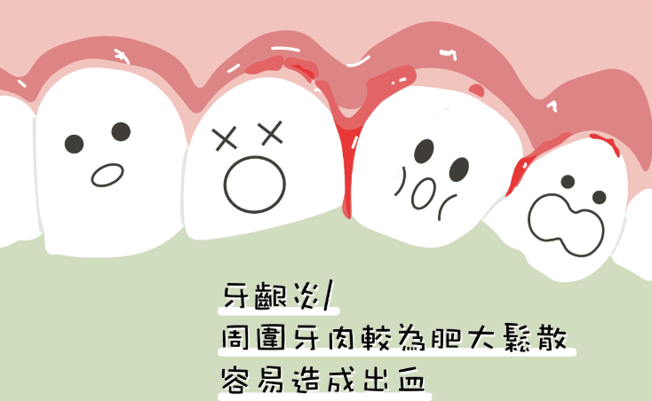 牙齦流血