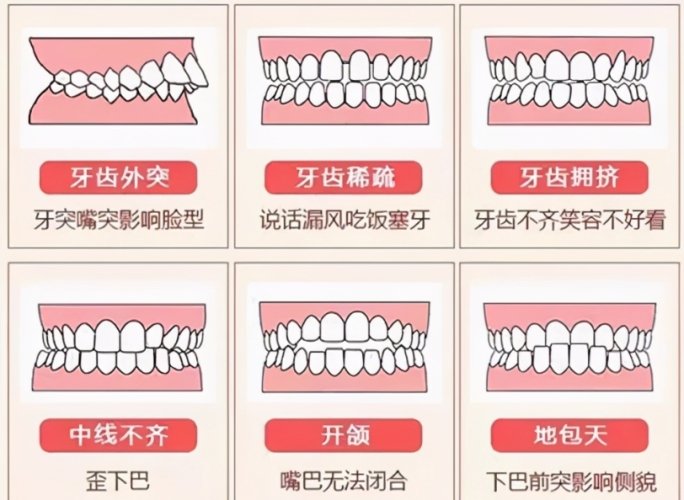 深咬