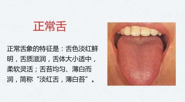 舌頭裂紋治療