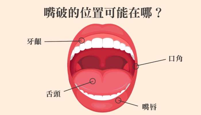 嘴巴破快速好