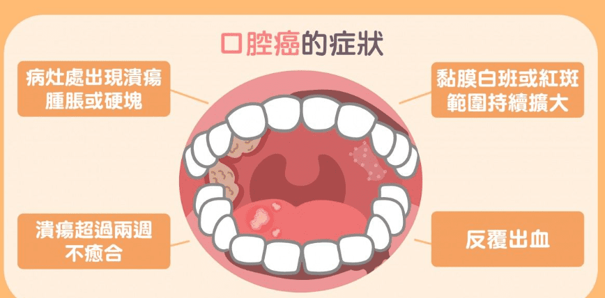 口腔癌前兆