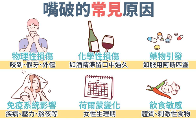 口腔潰瘍