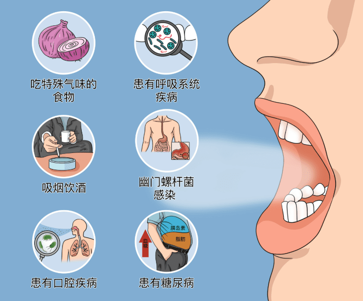 口臭原因