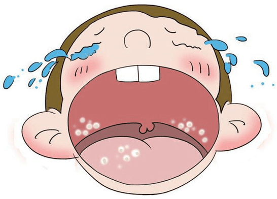 口腔白斑病因